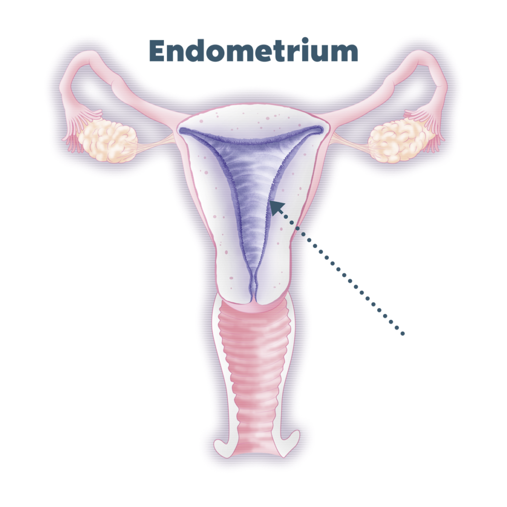 子宮內膜是什麼？子宮內膜是子宮內側的組織，也是懷孕期間胚胎著床與發育之處。 子宮內膜每個月都會準備好迎接胚胎的到來，若沒有受精卵著床，就會產生月經。 健康的子宮內膜應該充滿好的子宮內膜菌叢