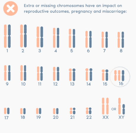 額外或缺失的染色體會對生殖結果、懷孕和流產產生影響